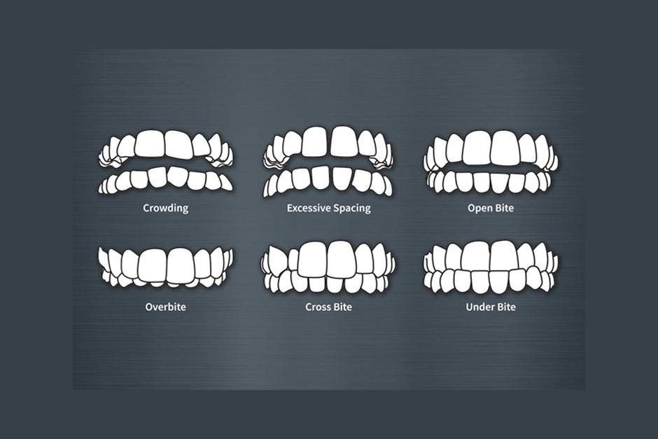 ارتودنسی دندان برای چه کسانی است ؟