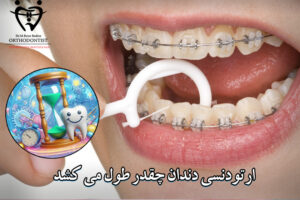 ارتودنسی دندان چقدر طول میکشد